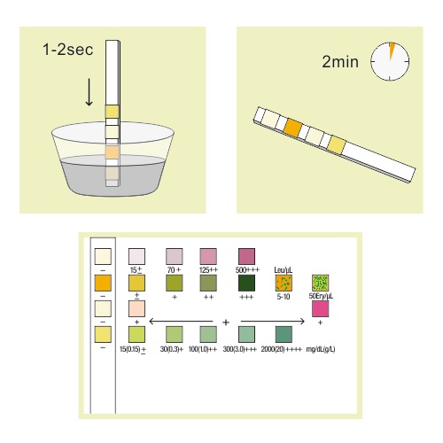 Bioplus Urinary Tract Infections (UTI) Τεστ Ουρολοίμωξης, 1τμχ