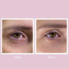 Youth Lab Peptides Spring Hydra-Gel Eye Patches Αντιρυτιδική & Συσφικτική Μάσκα Ματιών 60τμχ
