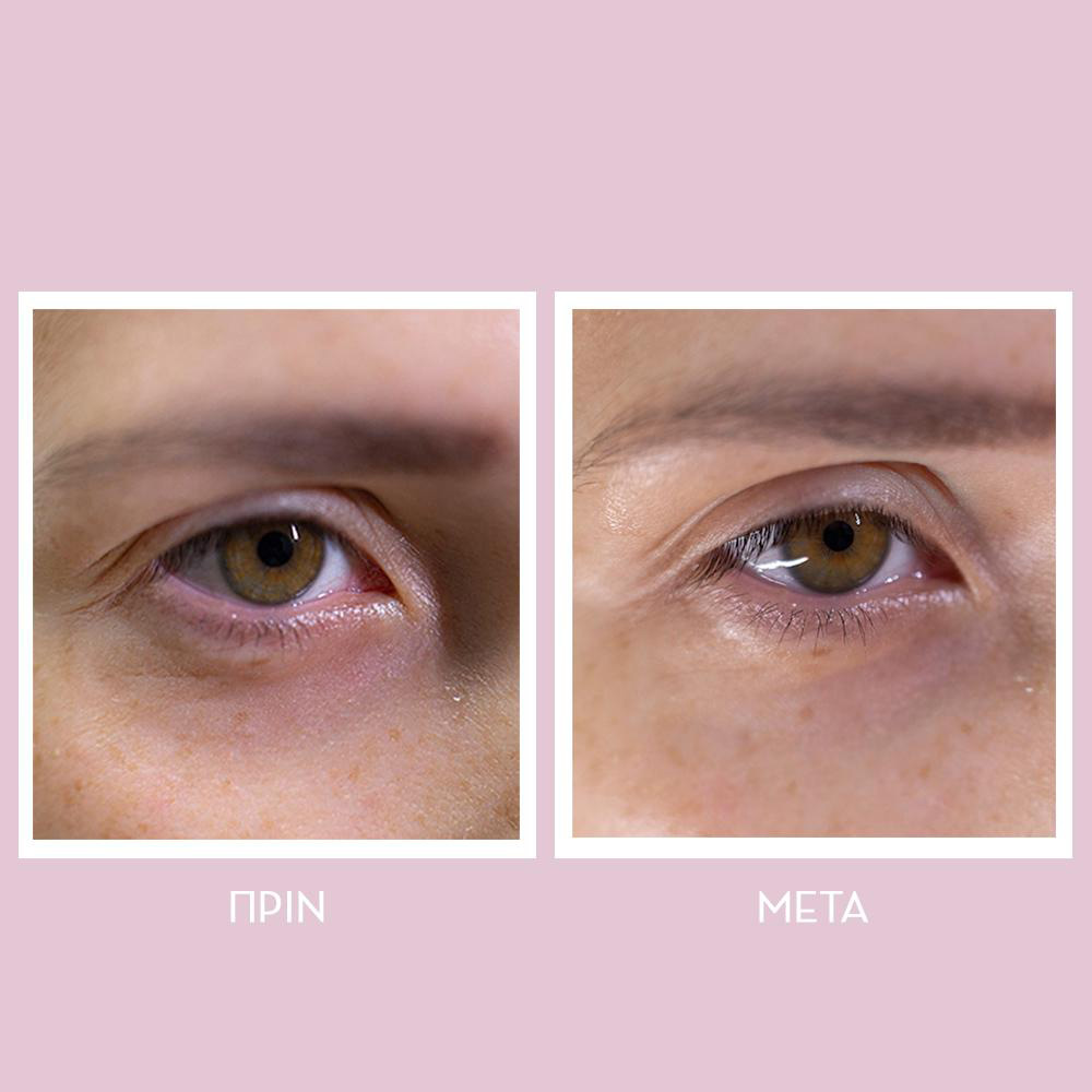 Youth Lab Peptides Spring Hydra-Gel Eye Patches Αντιρυτιδική & Συσφικτική Μάσκα Ματιών 60τμχ